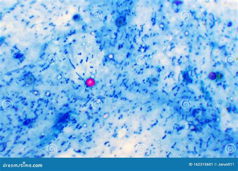  Cryptosporidium! A Microscopic Marvel Hiding In Plain Sight