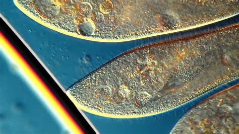  Paramecium! A Microscopic Wonder That Swims and Eats Like It Owns the Place